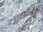 ZNF365 Antibody in Immunohistochemistry (Paraffin) (IHC (P))