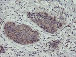 ZNF365 Antibody in Immunohistochemistry (Paraffin) (IHC (P))