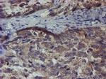 ZNF365 Antibody in Immunohistochemistry (Paraffin) (IHC (P))