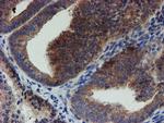 ZNF365 Antibody in Immunohistochemistry (Paraffin) (IHC (P))