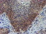 ZNF365 Antibody in Immunohistochemistry (Paraffin) (IHC (P))