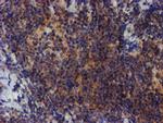ZNF365 Antibody in Immunohistochemistry (Paraffin) (IHC (P))