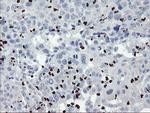 ZNF365 Antibody in Immunohistochemistry (Paraffin) (IHC (P))