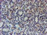 ZNF365 Antibody in Immunohistochemistry (Paraffin) (IHC (P))