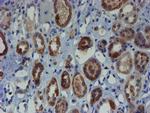 ZNF365 Antibody in Immunohistochemistry (Paraffin) (IHC (P))