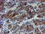 ZNF365 Antibody in Immunohistochemistry (Paraffin) (IHC (P))