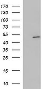 ZNF365 Antibody in Western Blot (WB)
