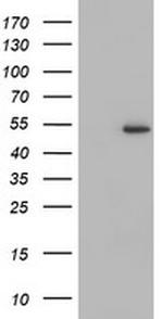 ZNF365 Antibody in Western Blot (WB)