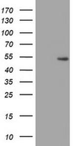 ZNF365 Antibody in Western Blot (WB)