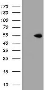 ZNF365 Antibody in Western Blot (WB)