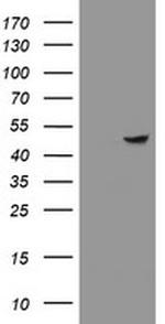 ZNF365 Antibody in Western Blot (WB)
