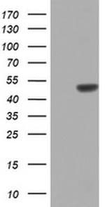ZNF385B Antibody in Western Blot (WB)