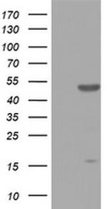 ZNF385B Antibody in Western Blot (WB)