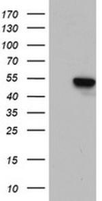 ZNF385B Antibody in Western Blot (WB)