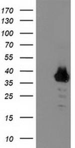 ZNF397 Antibody in Western Blot (WB)