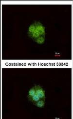 ZNF397 Antibody in Immunocytochemistry (ICC/IF)