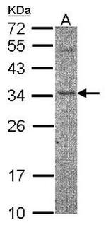 ZNF397 Antibody in Western Blot (WB)