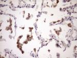 ZNF449 Antibody in Immunohistochemistry (Paraffin) (IHC (P))