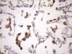 ZNF449 Antibody in Immunohistochemistry (Paraffin) (IHC (P))