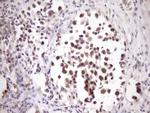 ZNF449 Antibody in Immunohistochemistry (Paraffin) (IHC (P))