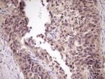 ZNF449 Antibody in Immunohistochemistry (Paraffin) (IHC (P))