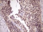 ZNF449 Antibody in Immunohistochemistry (Paraffin) (IHC (P))