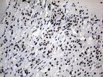 ZNF454 Antibody in Immunohistochemistry (Paraffin) (IHC (P))