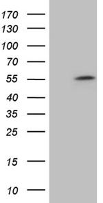 ZNF454 Antibody in Western Blot (WB)