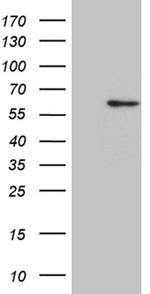 ZNF454 Antibody in Western Blot (WB)