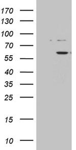 ZNF454 Antibody in Western Blot (WB)