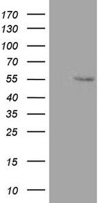ZNF500 Antibody in Western Blot (WB)