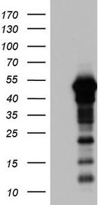 ZNF500 Antibody in Western Blot (WB)