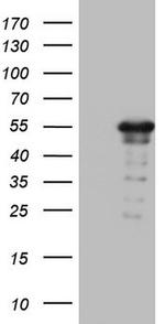 ZNF500 Antibody in Western Blot (WB)