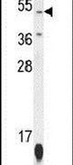 ZNF566 Antibody in Western Blot (WB)