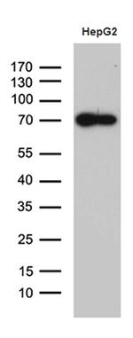 ZNF572 Antibody in Western Blot (WB)
