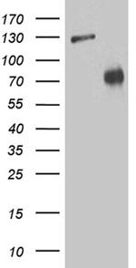 ZNF572 Antibody in Western Blot (WB)