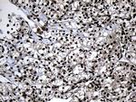 ZNF583 Antibody in Immunohistochemistry (Paraffin) (IHC (P))