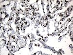 ZNF583 Antibody in Immunohistochemistry (Paraffin) (IHC (P))