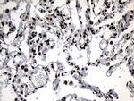 ZNF583 Antibody in Immunohistochemistry (Paraffin) (IHC (P))