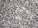 ZNF583 Antibody in Immunohistochemistry (Paraffin) (IHC (P))