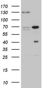 ZNF655 Antibody in Western Blot (WB)