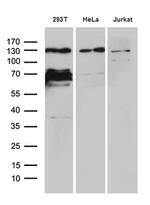 ZNF655 Antibody in Western Blot (WB)