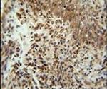 ZNF667 Antibody in Immunohistochemistry (IHC)