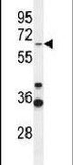 ZNF667 Antibody in Western Blot (WB)