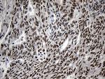 ZNF670 Antibody in Immunohistochemistry (Paraffin) (IHC (P))