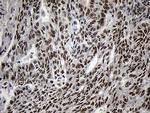 ZNF670 Antibody in Immunohistochemistry (Paraffin) (IHC (P))