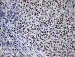 ZNF670 Antibody in Immunohistochemistry (Paraffin) (IHC (P))