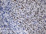 ZNF670 Antibody in Immunohistochemistry (Paraffin) (IHC (P))