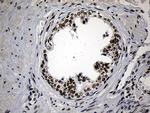 ZNF670 Antibody in Immunohistochemistry (Paraffin) (IHC (P))