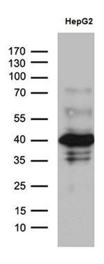 ZNF670 Antibody in Western Blot (WB)